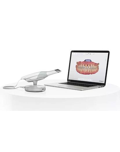 3 D digital dental impression scanner and images on computer screen