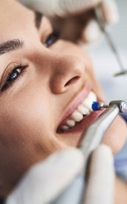 Woman at a dental cleaning