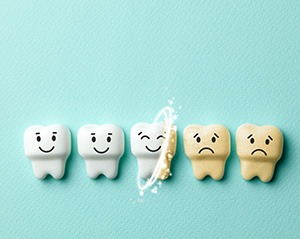 Factors that affect the cost of teeth whitening include how deeply your teeth are stained