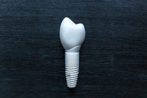 closeup of zirconia dental implant 