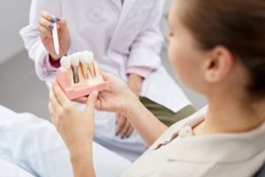Woman holding a model of dental implants at the dentist’s office.