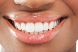 Close-up of smile featuring very white teeth.